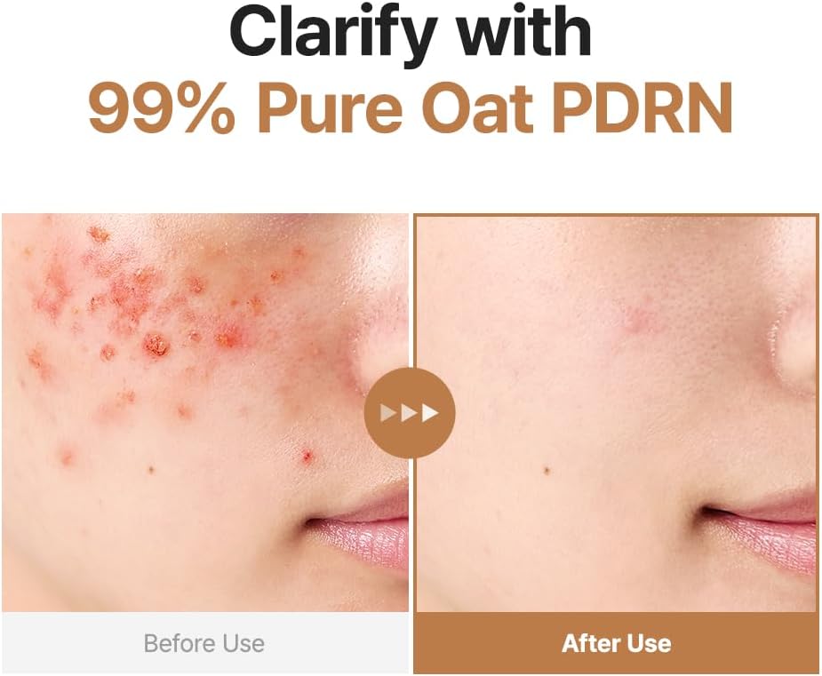 Purito Seoul - Oat PDRN Gentle Refining Toner