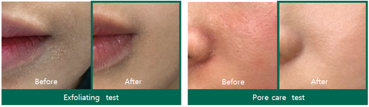 SOME BY MI - AHA BHA PHA Miracle Toner